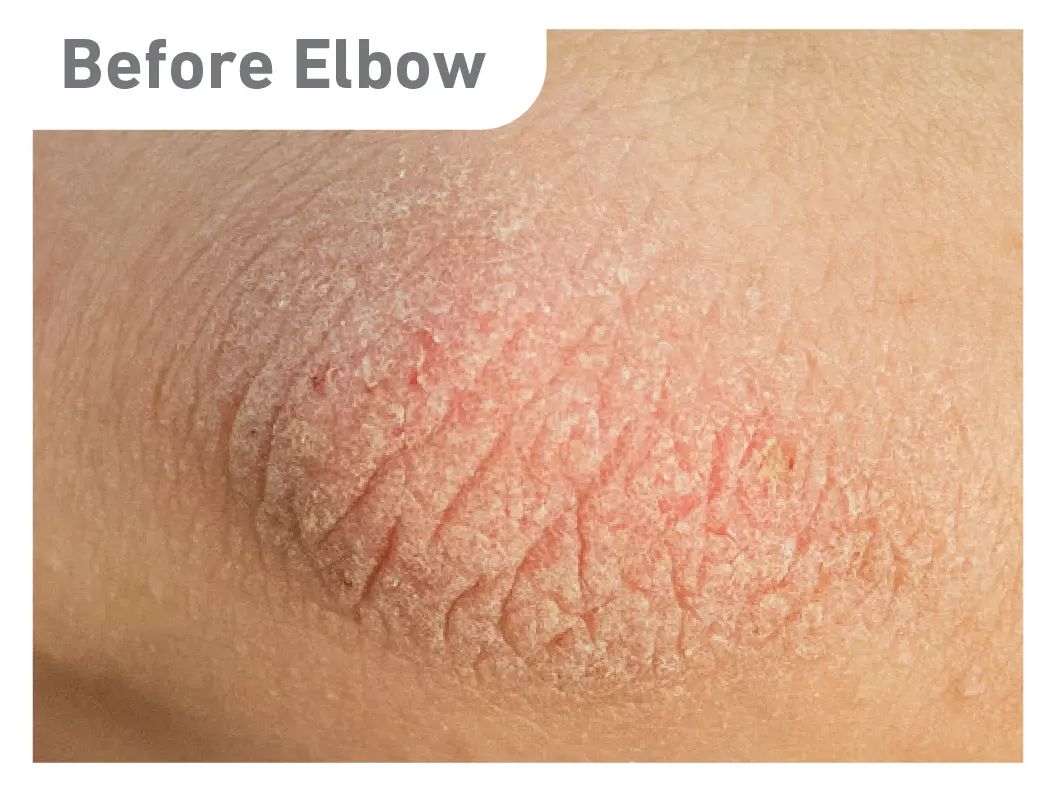 O'Keeffe's Skin Repair Ultimate Relief: Guaranteed Relief for